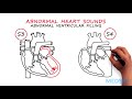 Abnormal Heartsounds and Murmurs: Which heart sounds should worry you