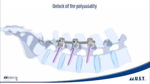 Medacta: VIDEO  M U S T   Design Rationale