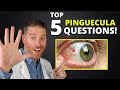 Yellow Spot On Your Eye (Pinguecula) - Top 5 Questions Answered!