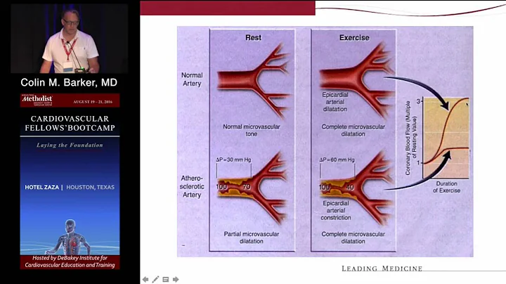 IVUS and FFR (Colin M. Barker, MD) Saturday, August 20, 2016