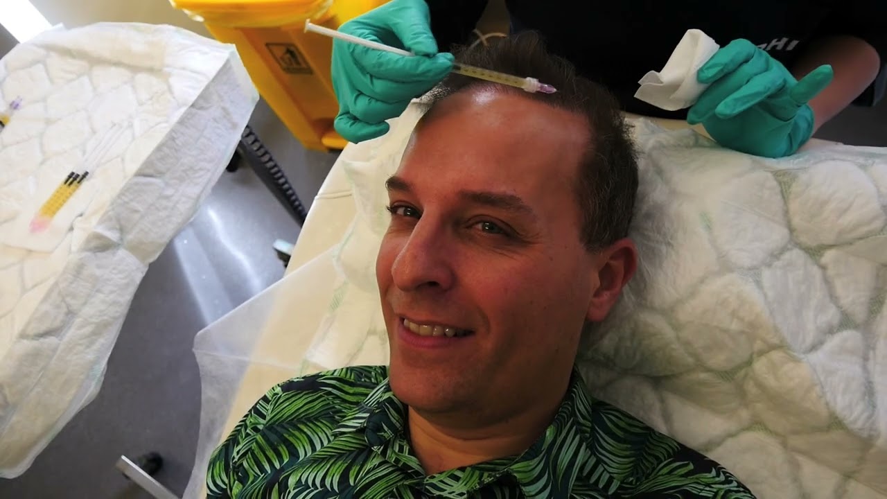 DHI PRP Hair Loss Treatment