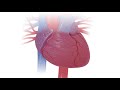 What is SCD (sudden cardiac death)