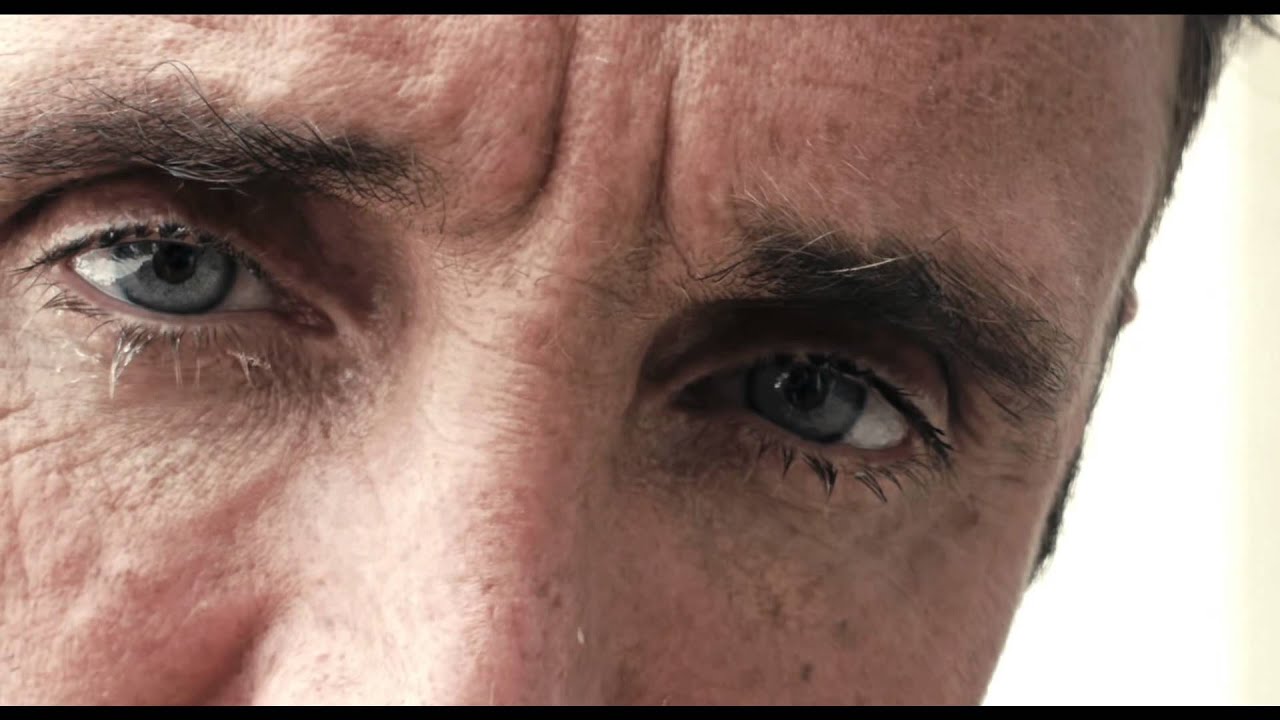 Permanently changed my eye color to look like Elvis Presley's eyes