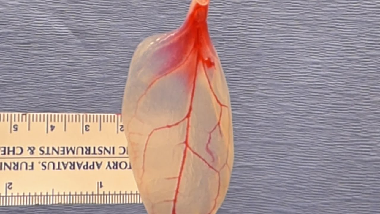 Institute wants to create transplant organs for injured vets