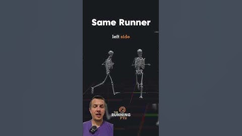 3D Gait Analysis Breakdown. 𝗟𝗲𝗳𝘁 𝗛𝗶𝗽 𝗣𝗮𝗶𝗻