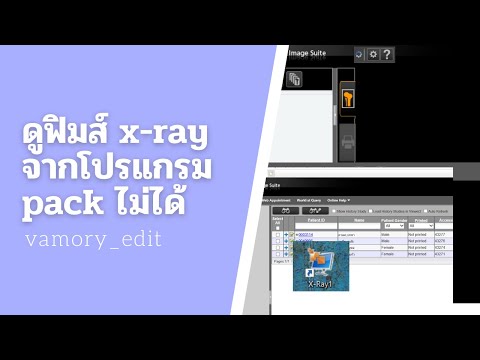 วีดีโอ: ไฟล์ Xray เป็นไฟล์รูปแบบใด?