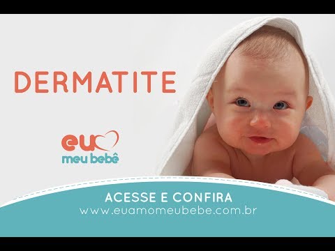 Espinhas e erupções na pele do bebê, o que fazer? [Tudo sobre Dermatites em Crianças]