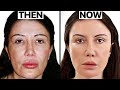 Plastic Surgery Demystified with Lorry Hill | Dr. Gary Linkov