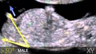 Baby 'Nub Theory' Explained!