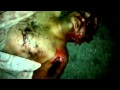 قطات قاسية جدا الشهيد هيثم هلال القرابيص حمص 5 9 2011 قطات قاسية جدا الشهيد هيثم هلال القرابيص حمص 5 9 2011