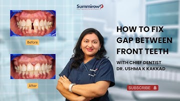 How to Fix Gap Between Front Teeth | Dr. Ushma Kakkad Explains Treatment Options"