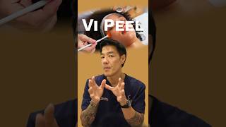 What is the Vi Peel?