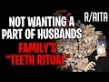 AITA Not Wanting A Part Of Husbands Family "Teeth Ritual" (r/aita)