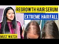 21 Days Hair Challenge : Ayurvedic Nuskha to Stop Hair Fall and REGROW New Hair || Self Care Secrets