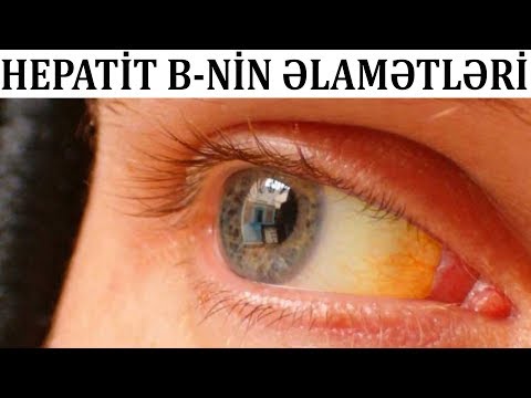 Video: Hansı hepatit b-nin təsiri ola bilər?