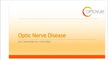 OCT Interpretation Session 8: Optic Nerve Disease