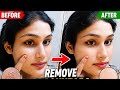 I tried removing blackheads for 7 days… here’s the shocking result 😳”