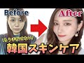 もう絶対手放せない韓国スキンケアアイテム！1か月間使った結果…