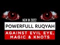 Most powerful ruqyah to destroy evil eye  magic in 2022