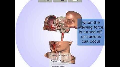 Exploded Views for Volume Data