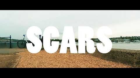 T - STACKS -  HOOD SCARS/INTRO | #OSMVision