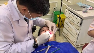 GẮN MẮC CÀI NIỀNG RĂNG PHA LÊ KHẮC PHỤC RĂNG KHẤP KHỂNH MỨC ĐỘ NẶNG, SAI KHỚP CẮN HẠNG 3