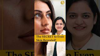 Pigmentation treatment | Best Dermatologist in Mumbai | Dr. Neerja S. Nellogi #ytshorts #shorts