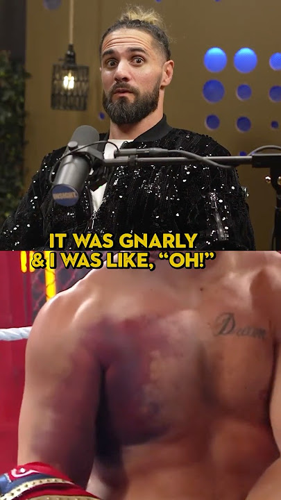 Cody Rhodes' Torn Pec Was NASTY