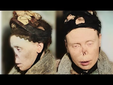 СИФИЛИС / КаК  САМАЯ ПОЗОРНАЯ ЗАРАЗА "ПОЖИРАЛА" ЕВРОПУ и РОССИЮ