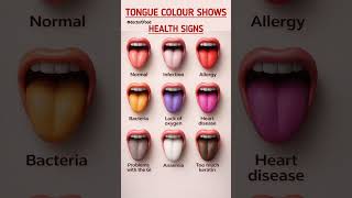 Tongue Color Reveals Hidden Health Signs | What Your Tongue Says About Your Health #healthylifestyle