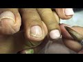 DIY ACRYLIC TOENAILS 😍How to pick up the PERFECT bead😳one-bead method‼️no tips