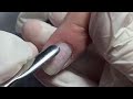 Cuticle remover step by step