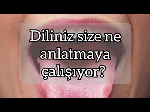 Video: Kenarlık görüntü dilimi nedir?