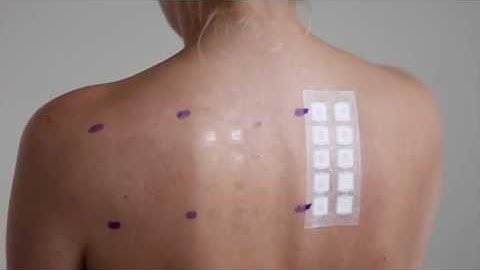 Patch test application