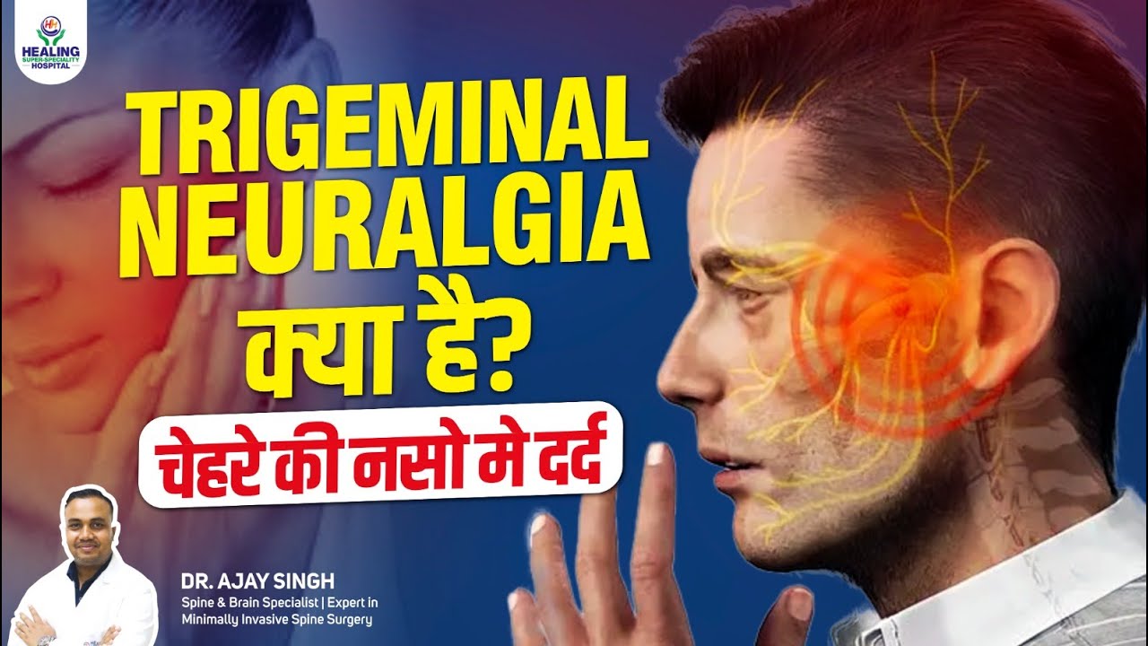 Trigeminal Neuralgia: Causes, Symptoms & Best Treatment Options ...