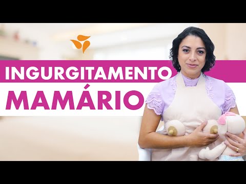 Vídeo: Ingurgitamento Mamário: Causas E Dicas Para Alívio