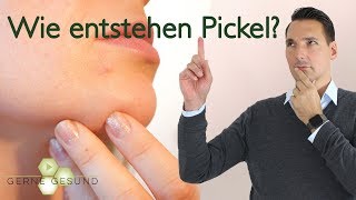 Pickel vs. Akne - Wie entstehen sie und kann ich ihnen vorbeugen? - Gerne Gesund