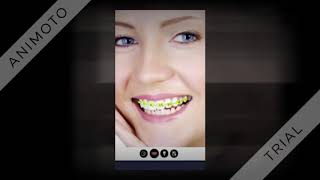 Braces teeth booth Photo pro accolades screenshot 1