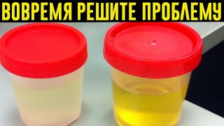 О чём говорит ЦВЕТ МОЧИ: от цистита до рака!