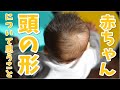 赤ちゃんの頭の形を整えるためにできること・治療の前に考えてみること(歯並び・姿勢)