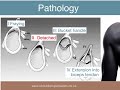 Clinical Anatomy of the Shoulder Girdle Part 2