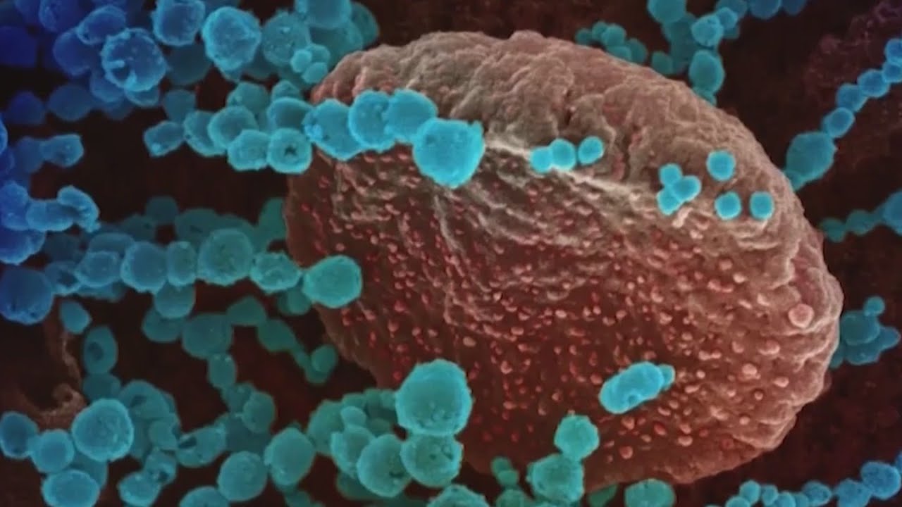 What local doctors are saying about new sub-variants of Omicron