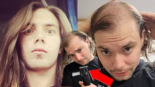 “I HAD Perfect Hair” BALDING Head Shave TRANSFORMATION