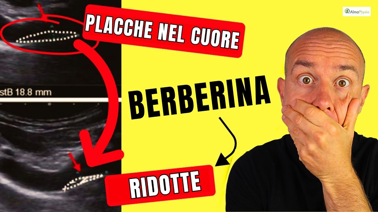 Questo CONTROVERSO SUPPLEMENTO riduce le PLACCHE nelle ARTERIE / BERBERINA