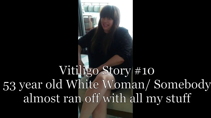 Vitiligo Story #10: 53 year old White Woman/ Someb...