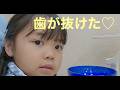 歯が抜けた♡朝ごはんは・・・｜予防歯科　原歯科医院【調布市・八雲台・布田駅】