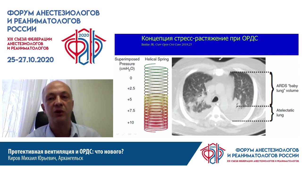 Протективная ИВЛ и ОРДС Киров М.Ю.