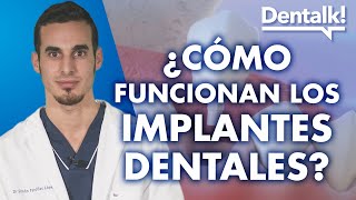 Cómo funcionan los implantes dentales – Dentalk! ©