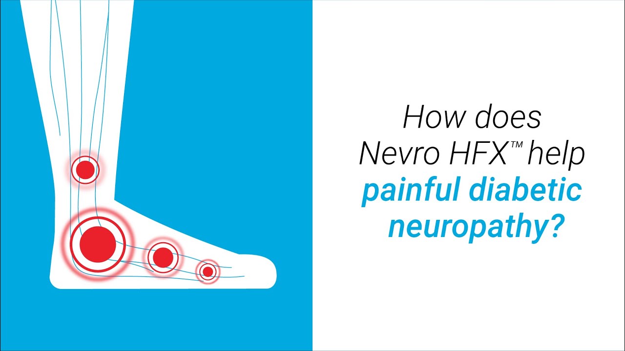 How Does Nevro HFX™ Help Painful Diabetic Neuropathy?