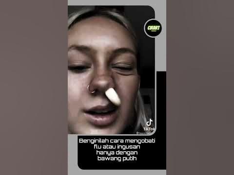 cara mengobati flu atau ingusan